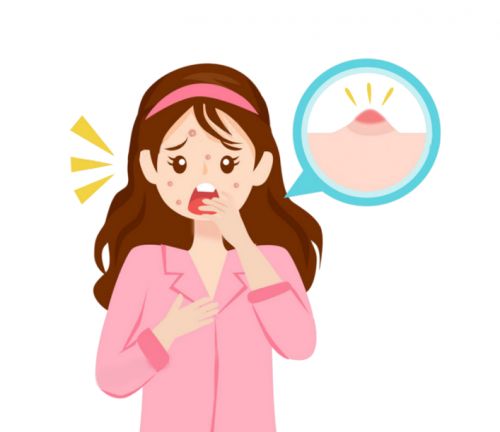 名口碑比较好的祛痘产品攻略请收好AG真人试玩平台祛痘印排行榜第一(图12)